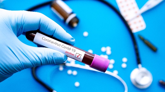 Covid-19 outbreak -world would not be same after this crisis